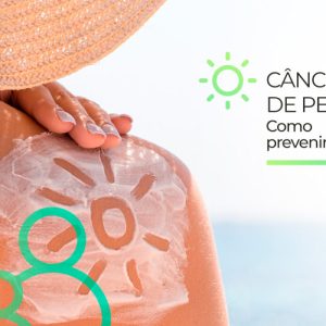 Img-Blog_Cancer-de-Pele_V01-1160×700